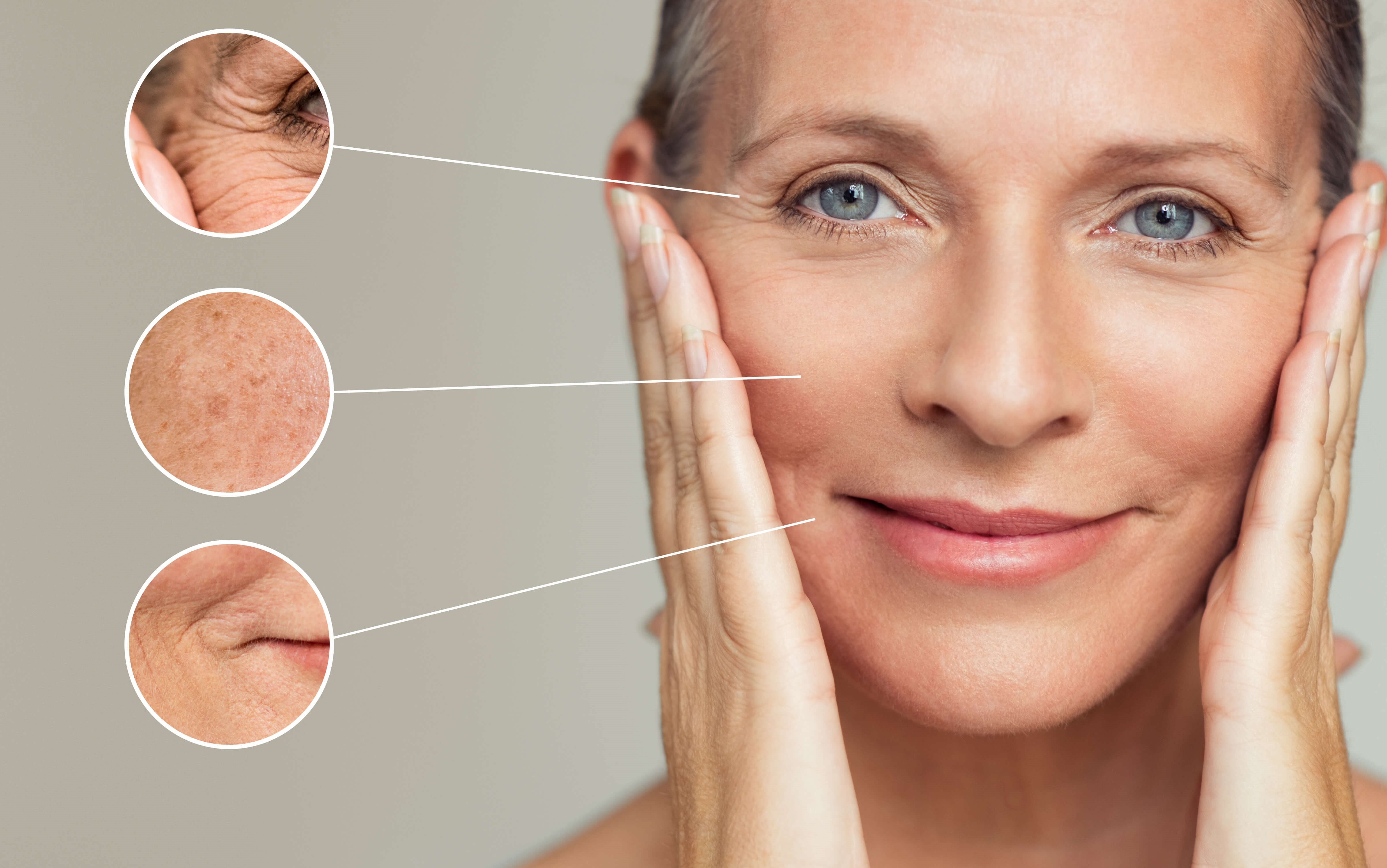 Can A Facelift Permanently Get Rid Of Wrinkles